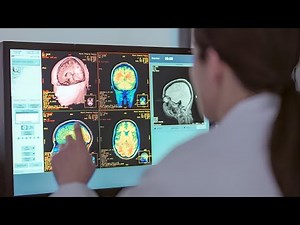 AI Breakthrough Offers Patients Early Warning for Alzheimer’s Disease