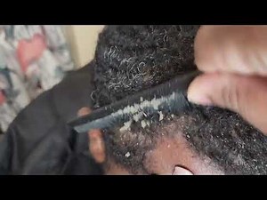 Dandruff Scratching | Channel Update!