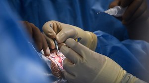 How long does it take to recover from laparoscopic surgery?