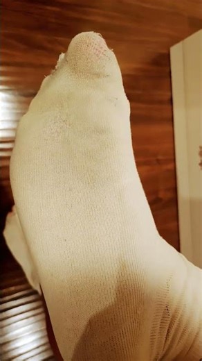 Day 37 white sock challenge