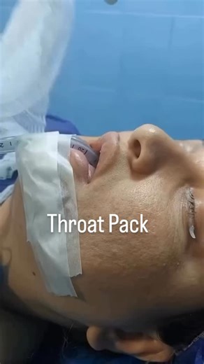 amjad on Instagram‎: "طريقة وضع throat pack في عمليات تجميل الأنف"‎