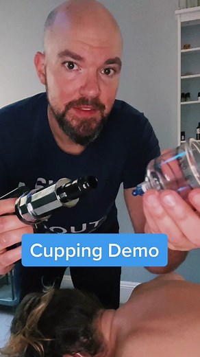 Cupping Therapy Demonstration for Relaxation and Pain Relief