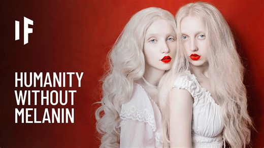 The Fascinating Science Behind a Fully Albino World