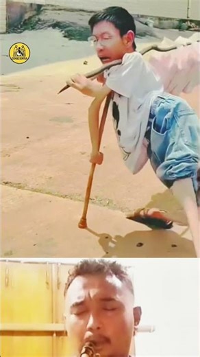 #disability #shortvideo #short