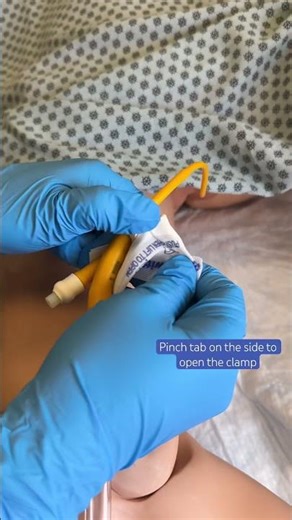 How to Remove a Stat Lock Securement Device