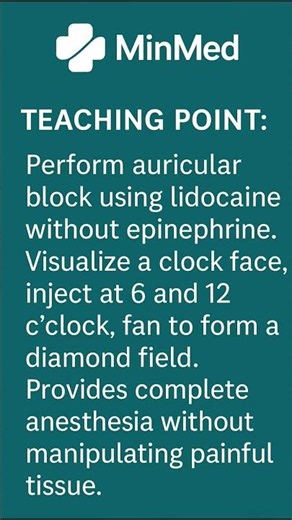 💉 Auricular Block Made Easy: Diamond Field for Painless Relief!