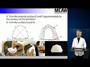 17.Model Fabrication