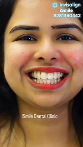 Invisalign® at iSmile Dental Clinic Your smile can be aligned gently and comfortably with clear aligners. No metal brackets. No wires. A modern way to straighten teeth while you continue your daily routine. 📍 iSmile Dental Clinic, Kesavadasapuram 📞 8281350442 🗺️ Location: https://maps.app.goo.gl/L4TQ8iFc3e3sXkH17 | I Smile Advanced Orthodontics