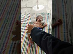 Baby on O2 support via hood 🫁!