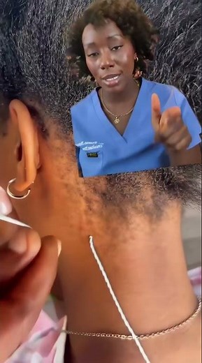 Traction Alopecia Due To Hairstyles
