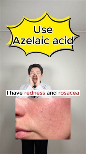 💊Pharmacist's Guide to Azelaic Acid ✨