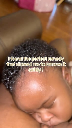 1K reactions · 95 shares | How to rmeove cradle cap safely and...