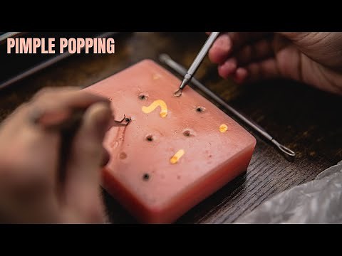 ASMR - PIMPLE POPPING! (Very satisfying & relaxing sounds)