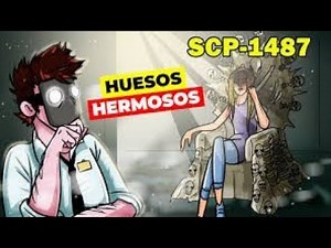 SCP 1487 - Huesos hermosos