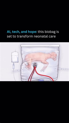 AI Tools I Artificial Intelligence I Business on Instagram: "Discover the revolutionary artificial womb breakthrough showcased in a Tech Insider video from the Children’s Hospital of Philadelphia. Researchers have engineered a “biobag”, a see through, liquid filled sac that mimics a mother’s uterus, nurturing premature fetal lambs. Through tubes linked to the umbilical cord, it supplies essential oxygen and nutrients, completely sidestepping the need for immature lungs. Observe these delicate la