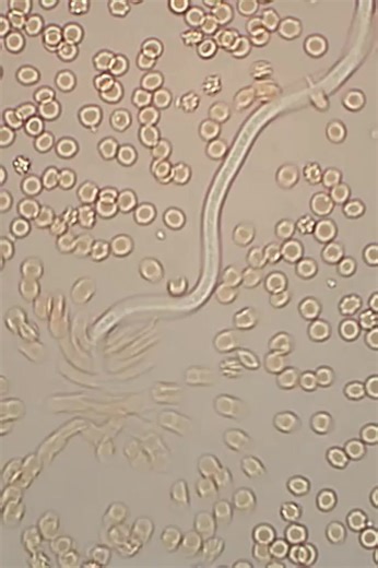 Blood sample 🥰🥰 Some people will say snake under microscope 🤣🤣 #lablife #MedicalLabTechnician #diagnosis | Lab life