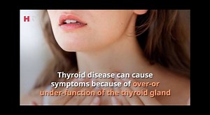 18K views · 239 reactions | Common symptoms of thyroid disease - HTV | HTV | Facebook