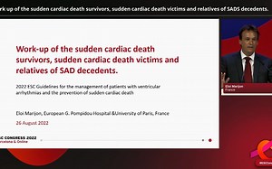 医学指南-2022年ESC室性心律失常患者管理及心源性猝死预防指南(2022 ESC Guidelines)