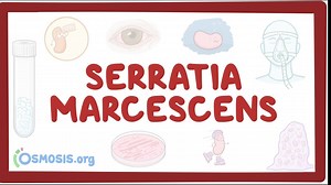 Serratia marcescens: Video, Causes, & Meaning | Osmosis