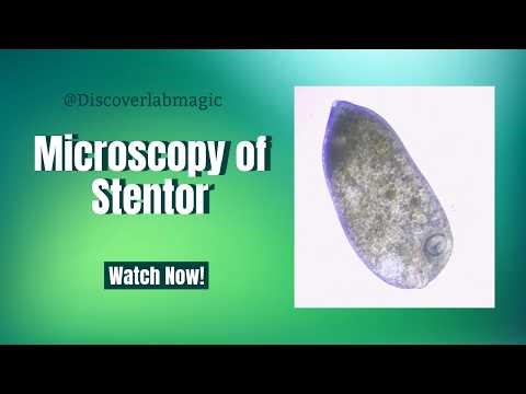 Experiment # 31 Microscopy of Stentor