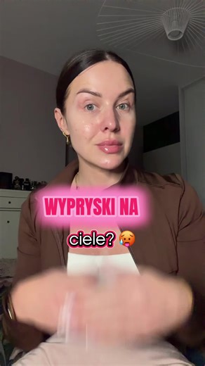 Szybko pozbądź się wyprysków na ciele z balsamem