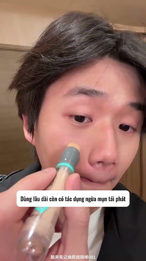 Mỗi khi đến dịp quan trọng là những cái mụn tự nhô lên thì thật sự bất lực #shortvideo #lamdep