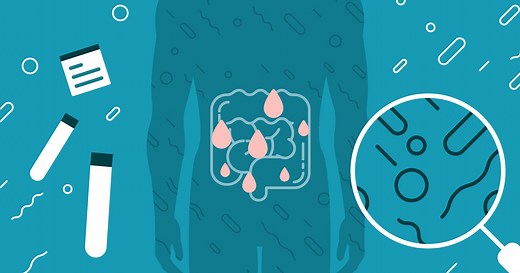 Leaky Gut Syndrome: The Complete Guide (2024) | Healthpath