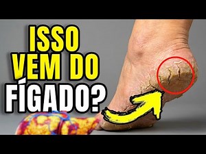 FÍGADO MORRENDO: O SINAL NO SEU PÉ QUE PODE SALVAR SUA VIDA!