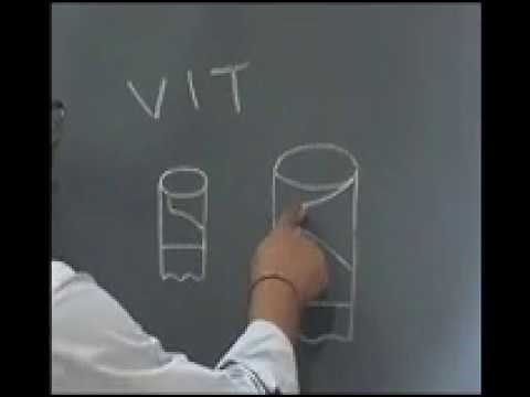 Variable Injection timing (VIT) of fuel in engines