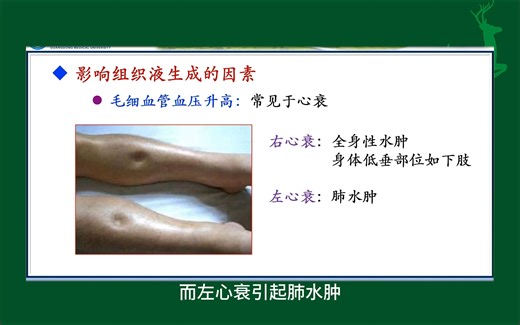 #组织液的生成#人体生理学#医学科普#每天学习一点点