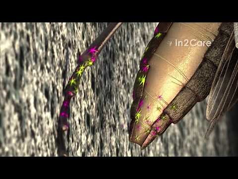 Video In2Care Mosquito Station US [old video version]