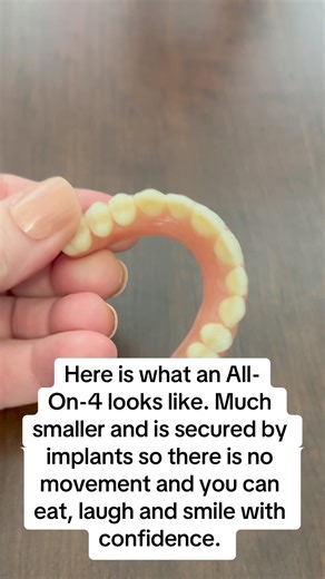 The main distinction between a denture and an All-On-4 lies in their functionality and support. While a complete upper denture relies on suction to the palate, an All-On-4 is a bridge that is supported by implants. This implant support ensures that the All-On-4 remains secure and immovable during activities such as eating, talking, laughing, and smiling. | East Coast Dental Centre
