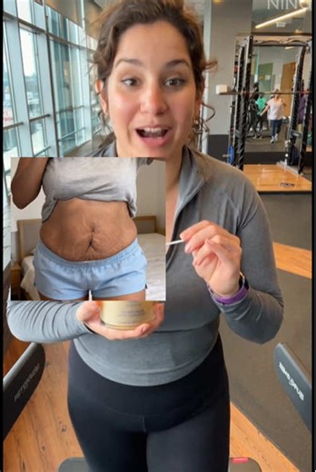 I frickn love this shit for my cellulite and stretch marks! #cellulite #stretchmarks #massageoil #TikTokShopHolidayHaul #ShopVideoCarnival