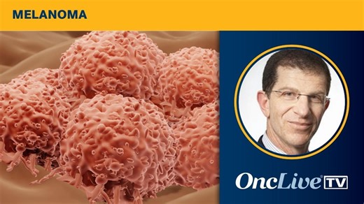 Dr Rischin on the Efficacy of Adjuvant Cemiplimab in High-Risk CSCC | OncLive