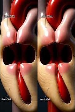 Inside the Human Heart: Aortic Valve Opening & Closing in Real-Time 🫀 | 21
