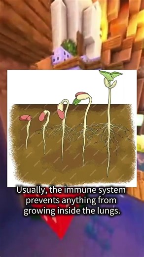 Fir tree seeds have sprouted inside a human lung #educational #facts #sciencefacts #sciencedaily