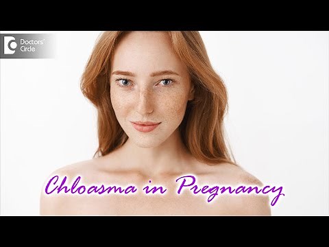 CHLOASMA IN PREGNANCY: What is it? Causes, Symptoms & Treatment - Dr.Aruna Prasad | Doctors' Circle