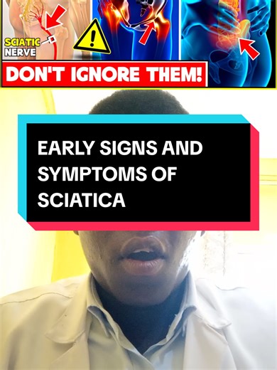 Some Early Signs And Symptoms Of Sciatica #sciatica #fyppppppppppppppppppppppp #viral #fyp #pain