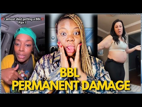 More Plastic Surgery Regrets People Are Finally Admitting