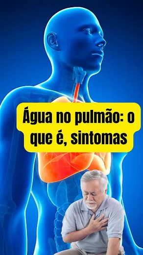 Sintomas de Água no Pulmão: Perigo e Cuidados