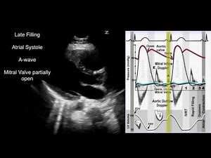 The Cardiac Cycle and Doppler Correlates