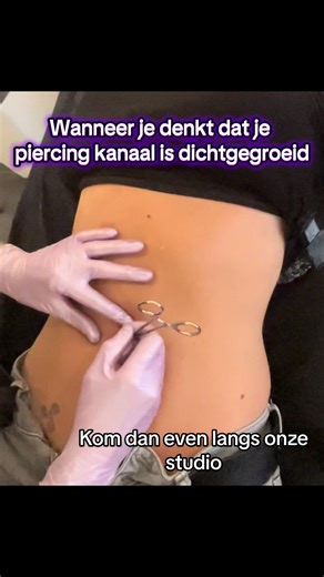 Wanneer je denkt dat je piercingkanaal dichtgegroeid is, kom dan even langs!! 9 van de 10 keer is het kanaal vernauwd en kan de piercing er met wat geduld weer doorheen 🤗 #piercing #piercingrotterdam #piercer #voorjou #navelpiercing