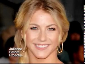 Julianne Hough Proactiv commercial