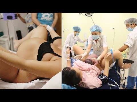 DIFFICULT AND DRAMATIC DELIVERY – HEARTBREAKING TO SEE THE MOTHER ENDURE SUCH HARDSHIP #birth #viral