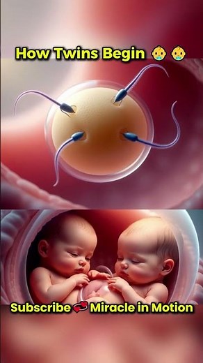 How Twins Are Formed, From Fertilization to Twin Development Explained #shorts #twins #pregnancy
