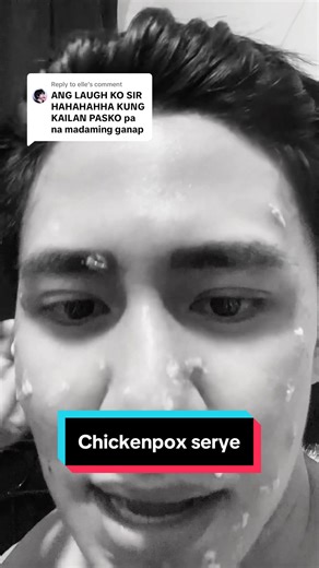 Understanding Chickenpox: Causes and Awareness