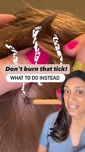 767K views · 1.1K reactions | Tick season is here, and prevention...