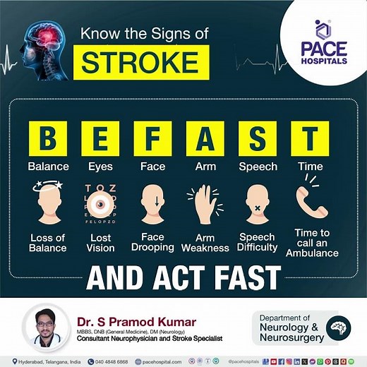 Brain Stroke Awareness | 7 Early Signs of a Stroke | Symptoms of a Stroke You Need to Know