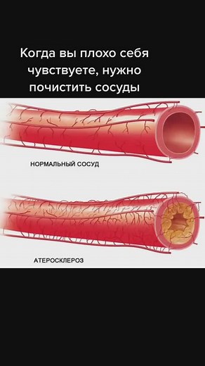 Азода TikTok'ta