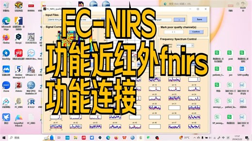 功能性近红外光谱技术fnirs功能连接FC-NIRS神经影像哈基米